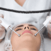 Ultralyds behandling ansigtsløftning